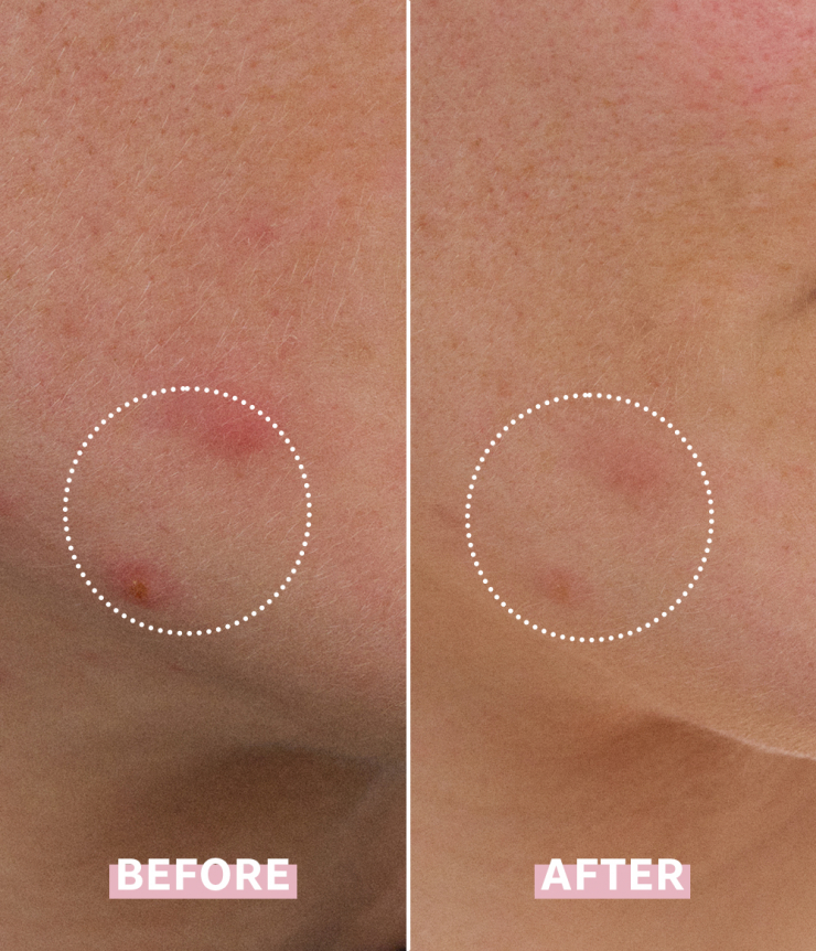 OH MY CICA SPOT GEL CREAM
