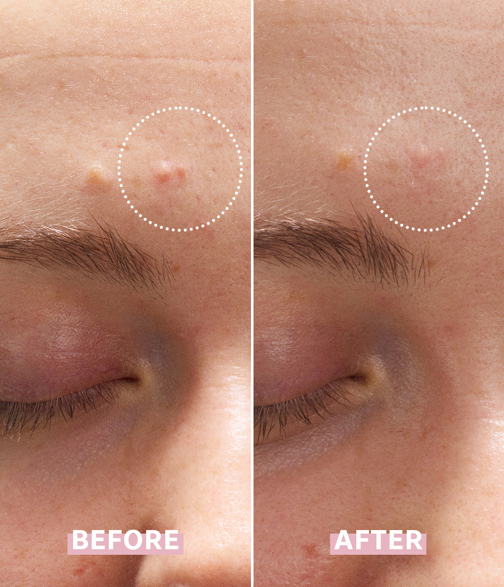 OH MY CICA SPOT GEL CREAM OH MY CICA SPOT GEL CREAM